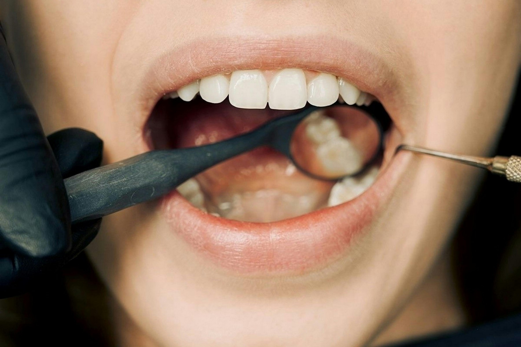 La Jolla Dentist Service Dentist La Jolla