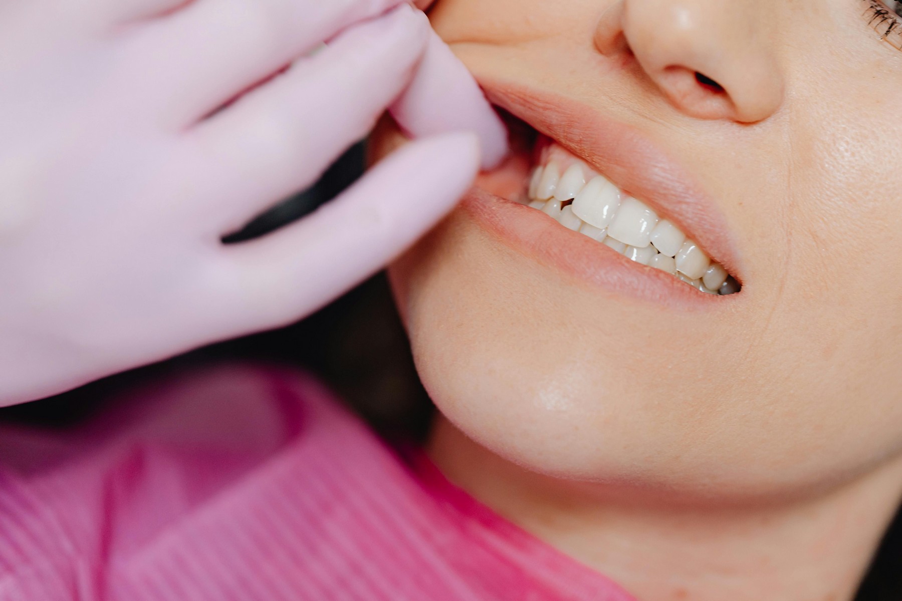 Mission Valley Dentist Service Dentist Mission Valley