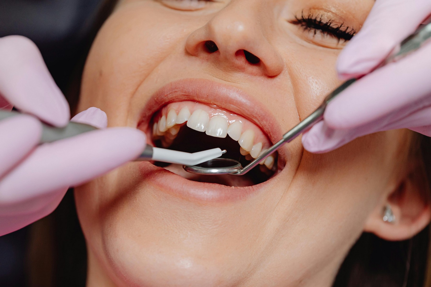 Dentist Poway 
