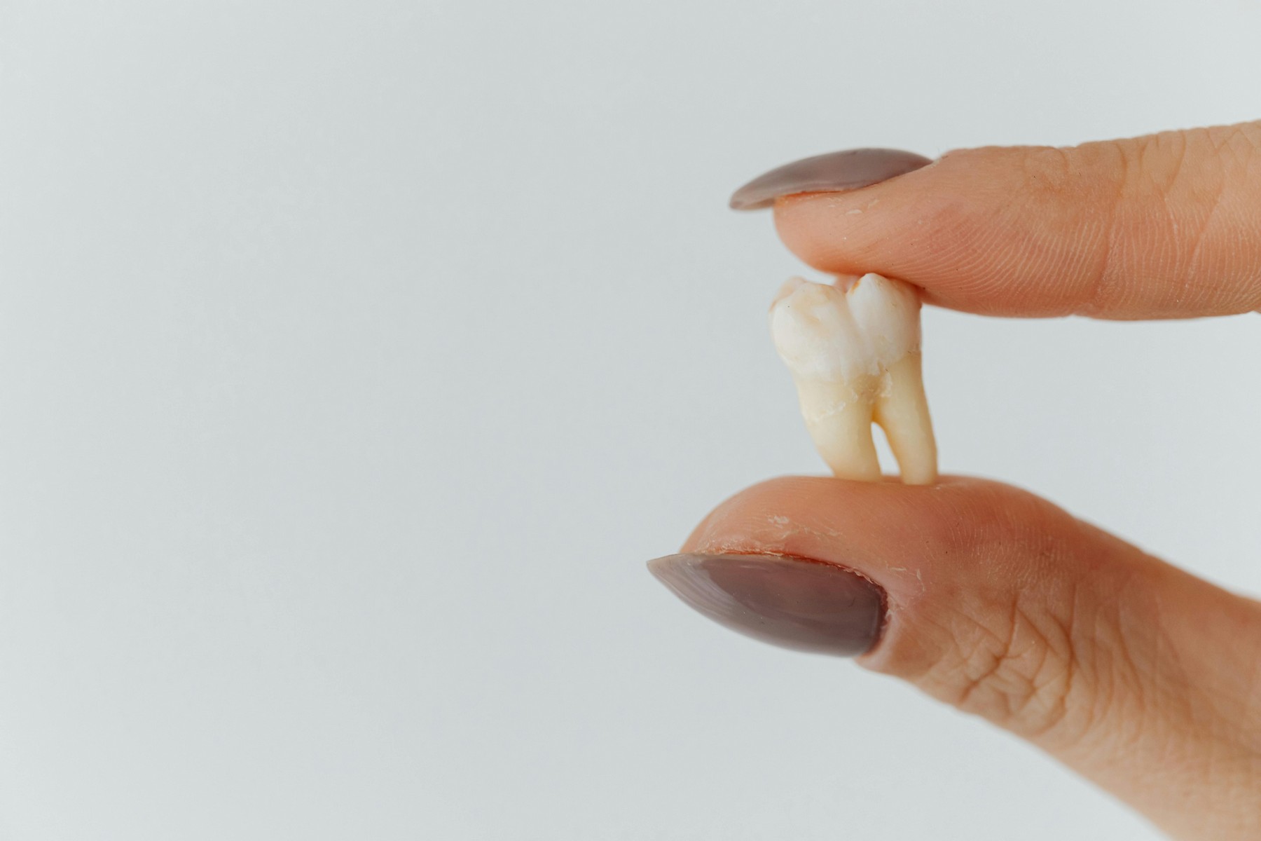 Dentist Solana Beach