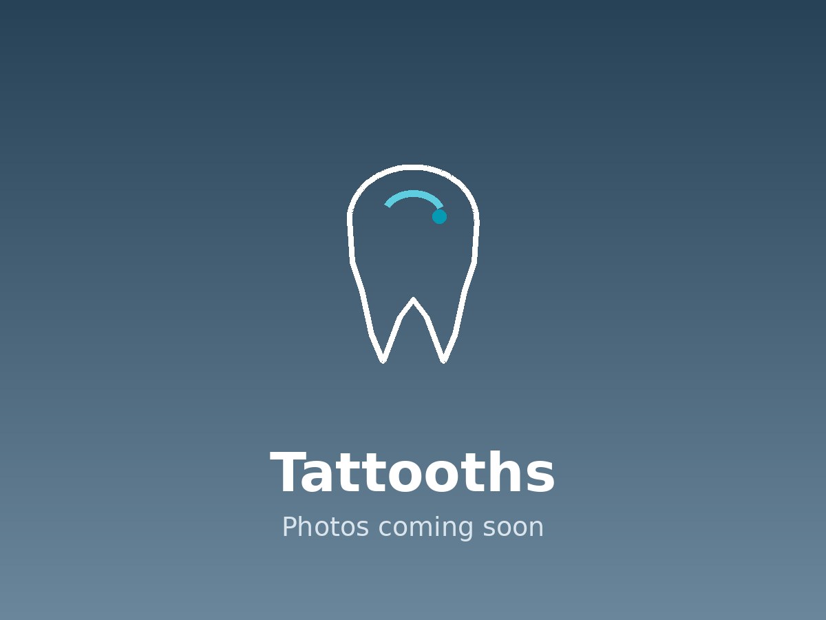 Placeholder for photographs of Tattooths, hand-painted artwork fired into a dental crown by Dr. Russell McCalley